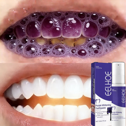 2026 Bestselling Whitening Toothpaste Say Goodbye To Yellow Teeth Oral Hygiene Cleaning and Teeth Care Tool
